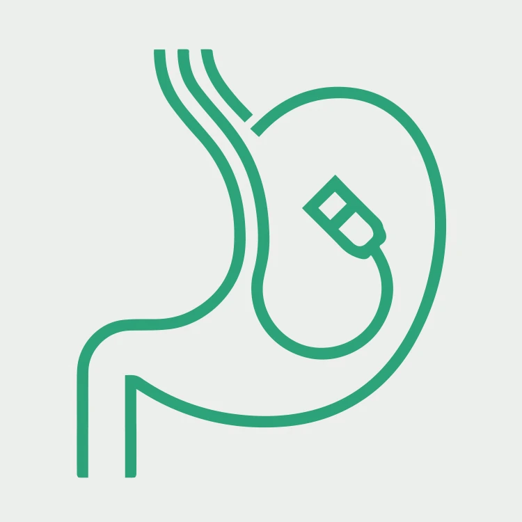 Mitra endoscopy solutions — gastric procedure visualisation